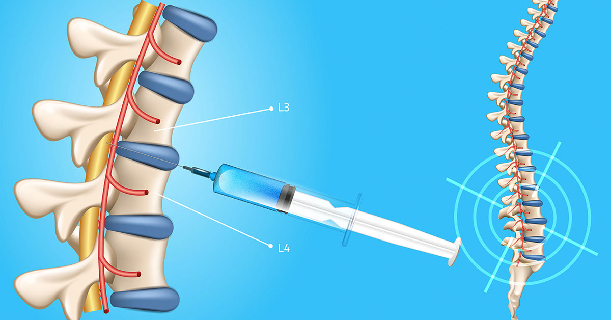 spinal tap needle