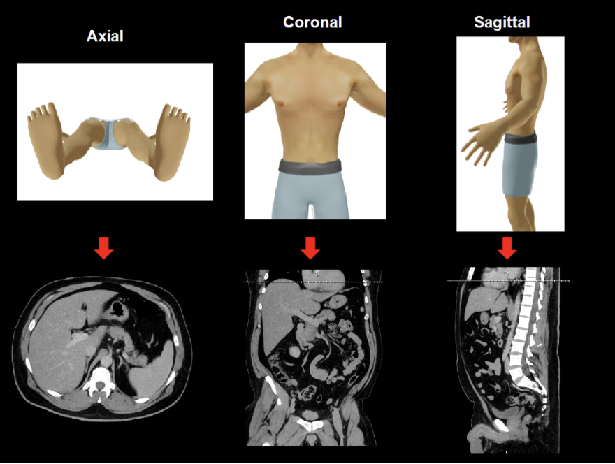 Different views of a CT scan