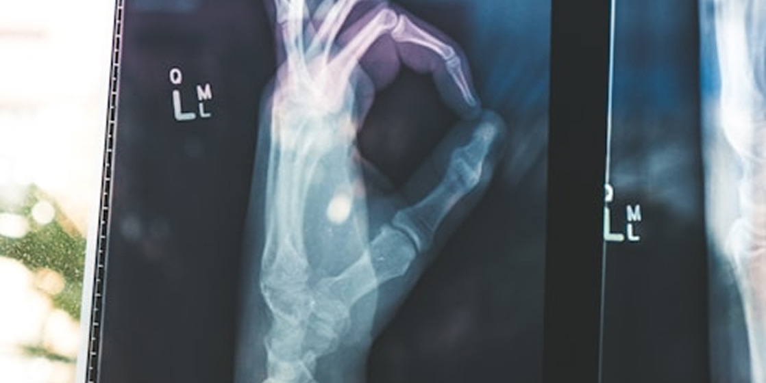 How Mediphany Provided Decisive Evidence in a Complex Workers' Compensation Case